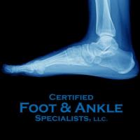 Foot and Ankle Treatment Boca Raton Florida