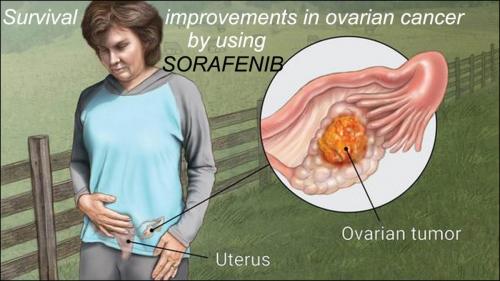 136-Survival-Improvements-in-Ovarian-Cancer-by-using-Sorafenib